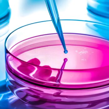 Messen & Prüfen » Hygieneinspektion Lüftungsanlagen